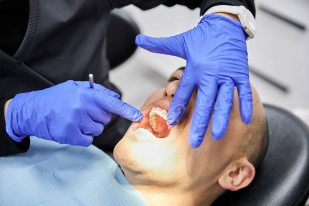 Teeth Whitening in UT